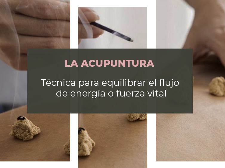 Acupuntura